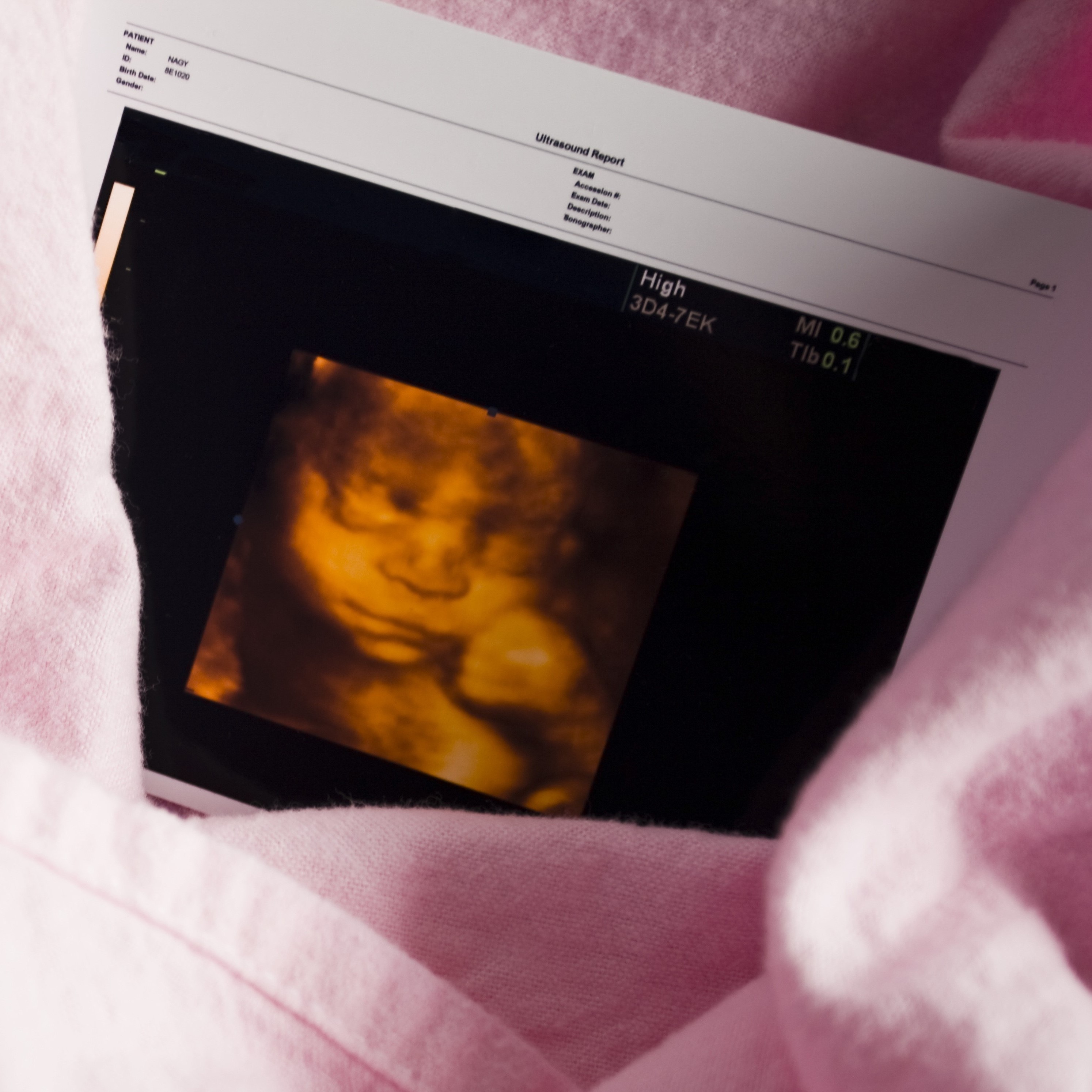 Why it is time to end home abortions