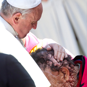 Francis' embrace ‘felt like Paradise’, says man disfigured by disease 